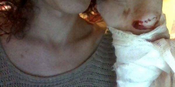 Haber | LGBTİ Derneği Sözcüsü Kıvılcım Arat, saldırıya uğradı